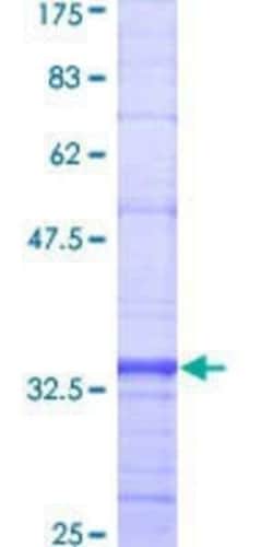 Novus Biologicals Recombinant Human CX3CR1 GST (N-Term) Protein 25 &mu;g | Buy Online | Novus Biologicals&trade; | Fisher Scientific