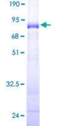Novus Biologicals Recombinant Human TEX28 GST (N-Term) Protein 25 &mu;g | Buy Online | Novus Biologicals&trade; | Fisher Scientific