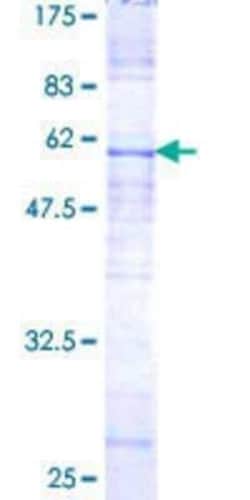 Novus Biologicals Recombinant Human CYC1 GST (N-Term) Protein 10 &mu;g | Buy Online | Novus Biologicals&trade; | Fisher Scientific