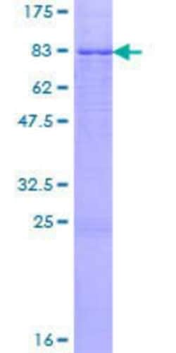 Novus Biologicals Recombinant Human Cytochrome P450 1A2 GST (N-Term) Protein 2 &mu;g | Buy Online | Novus Biologicals&trade; | Fisher Scientific