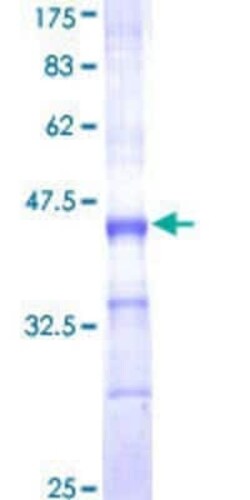 Novus Biologicals Recombinant Human Cytochrome P450 1A2 GST (N-Term) Protein 25 &mu;g | Buy Online | Novus Biologicals&trade; | Fisher Scientific