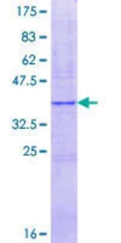 Novus Biologicals Recombinant Human CYP2A13 GST (N-Term) Protein 25 &mu;g | Buy Online | Novus Biologicals&trade; | Fisher Scientific
