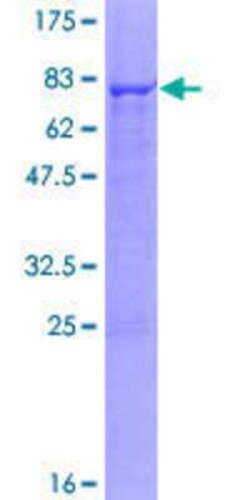 Novus Biologicals&trade;&nbsp;Recombinant Human Cytochrome P450 2C18 GST (N-Term) Protein