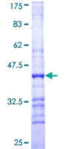 Novus Biologicals Recombinant Human Cytochrome P450 2D6 GST (N-Term) Protein 10 &mu;g | Buy Online | Novus Biologicals&trade; | Fisher Scientific