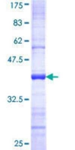 Novus Biologicals Recombinant Human CYP2F1 GST (N-Term) Protein 25 &mu;g | Buy Online | Novus Biologicals&trade; | Fisher Scientific