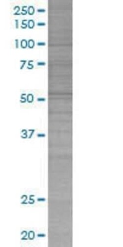 Novus Biologicals Cytochrome P450 3A4 293T Cell Transient Overexpression Lysate 0.1 mL | Buy Online | Novus Biologicals&trade; | Fisher Scientific