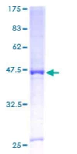 Novus Biologicals&trade;&nbsp;Recombinant Human Cytochrome P450 4A GST (N-Term) Protein