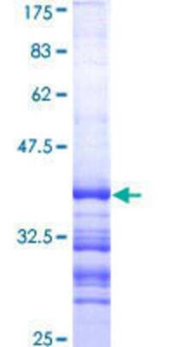 Novus Biologicals Recombinant Human CYP11A1 GST (N-Term) Protein 10 &mu;g | Buy Online | Novus Biologicals&trade; | Fisher Scientific