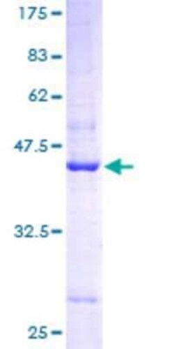 Novus Biologicals Recombinant Human Aromatase GST (N-Term) Protein 25 &mu;g | Buy Online | Novus Biologicals&trade; | Fisher Scientific