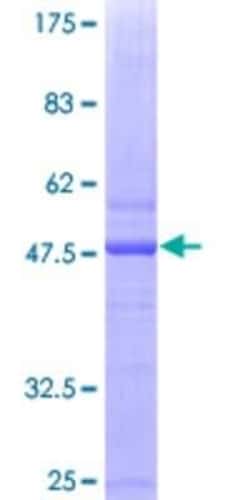 Novus Biologicals™ Recombinant Human Aromatase GST (N-Term) Protein