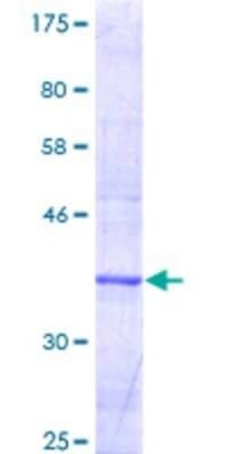 Novus Biologicals Recombinant Human CYP27B1 GST (N-Term) Protein 10 &mu;g | Buy Online | Novus Biologicals&trade; | Fisher Scientific