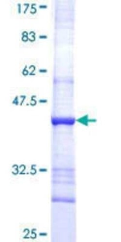 Novus Biologicals Recombinant Human CYP51A1 GST (N-Term) Protein 25 &mu;g | Buy Online | Novus Biologicals&trade; | Fisher Scientific