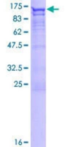 Novus Biologicals Recombinant Human DAB2 GST (N-Term) Protein 10 &mu;g | Buy Online | Novus Biologicals&trade; | Fisher Scientific