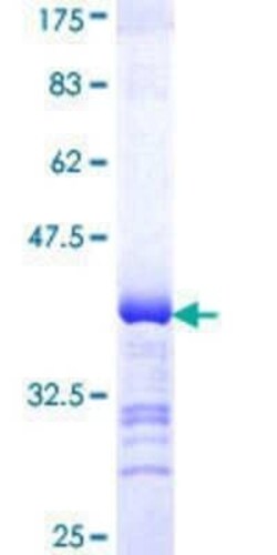 Novus Biologicals Recombinant Human DAB2 GST (N-Term) Protein 25 &mu;g | Buy Online | Novus Biologicals&trade; | Fisher Scientific