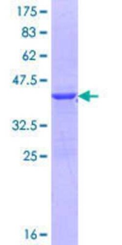 Novus Biologicals Recombinant Human DACH1 GST (N-Term) Protein 25 &mu;g | Buy Online | Novus Biologicals&trade; | Fisher Scientific