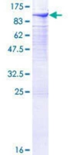 Novus Biologicals Recombinant Human DGK-alpha GST (N-Term) Protein 10 &mu;g | Buy Online | Novus Biologicals&trade; | Fisher Scientific