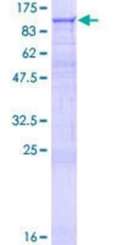 Novus Biologicals Recombinant Human DGK-gamma GST (N-Term) Protein 25 &mu;g | Buy Online | Novus Biologicals&trade; | Fisher Scientific