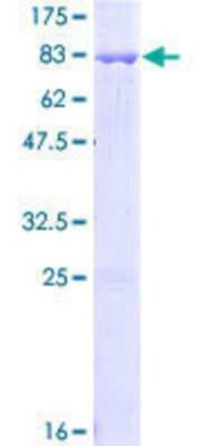 Novus Biologicals Recombinant Human DAPK3/ZIPK GST (N-Term) Protein 25 &mu;g | Buy Online | Novus Biologicals&trade; | Fisher Scientific