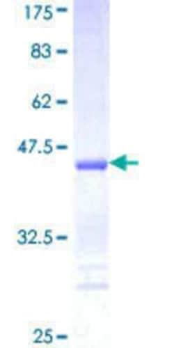 Novus Biologicals Recombinant Human DAPK3/ZIPK GST (N-Term) Protein 25 &mu;g | Buy Online | Novus Biologicals&trade; | Fisher Scientific