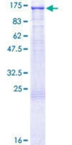 Novus Biologicals Recombinant Human Daxx GST (N-Term) Protein 25 &mu;g | Buy Online | Novus Biologicals&trade; | Fisher Scientific