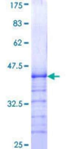 Novus Biologicals Recombinant Human Daxx GST (N-Term) Protein 25 &mu;g | Buy Online | Novus Biologicals&trade; | Fisher Scientific