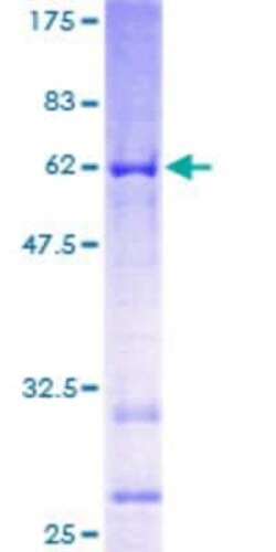 Novus Biologicals Recombinant Human DBC1 GST (N-Term) Protein 25 &mu;g | Buy Online | Novus Biologicals&trade; | Fisher Scientific