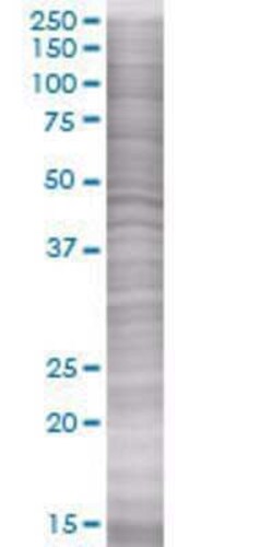 Novus Biologicals DBC1 293T Cell Transient Overexpression Lysate 0.1 mL | Buy Online | Novus Biologicals&trade; | Fisher Scientific