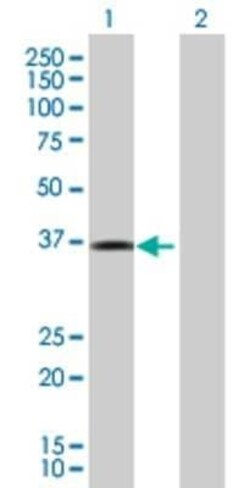 Novus Biologicals DBC1 293T Cell Transient Overexpression Lysate 0.1 mL | Buy Online | Novus Biologicals&trade; | Fisher Scientific