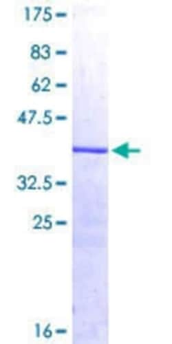 Novus Biologicals Recombinant Human D Box Binding Protein GST (N-Term) Protein 25 &mu;g | Buy Online | Novus Biologicals&trade; | Fisher Scientific