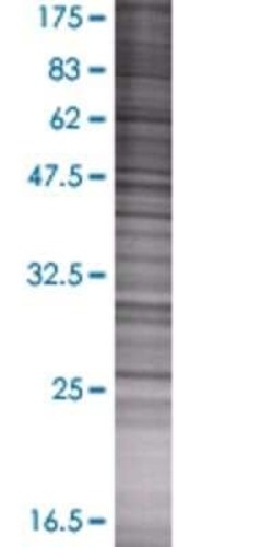 Novus Biologicals DCI 293T Cell Transient Overexpression Lysate 0.1 mL | Buy Online | Novus Biologicals&trade; | Fisher Scientific