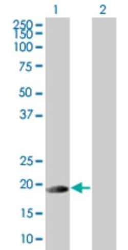 Novus Biologicals&trade;&nbsp;Deoxycytidylate deaminase 293T Cell Transient Overexpression Lysate