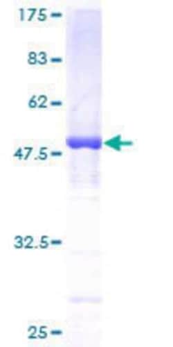 Novus Biologicals Recombinant Human Dynactin Subunit 1/DCTN1 GST (N-Term) Protein 25 &mu;g | Buy Online | Novus Biologicals&trade; | Fisher Scientific