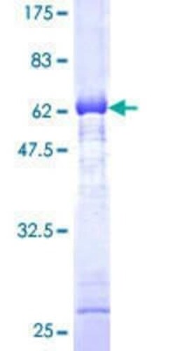 Novus Biologicals Recombinant Human AKR1C2 GST (N-Term) Protein 10 &mu;g | Buy Online | Novus Biologicals&trade; | Fisher Scientific