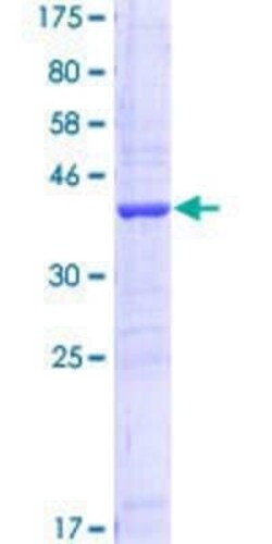 Novus Biologicals Recombinant Human AKR1C2 GST (N-Term) Protein 10 &mu;g | Buy Online | Novus Biologicals&trade; | Fisher Scientific