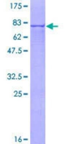 Novus Biologicals Recombinant Human DDOST GST (N-Term) Protein 25 &mu;g | Buy Online | Novus Biologicals&trade; | Fisher Scientific