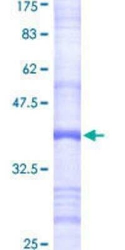 Novus Biologicals Recombinant Human DDOST GST (N-Term) Protein 10 &mu;g | Buy Online | Novus Biologicals&trade; | Fisher Scientific