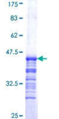 Novus Biologicals Recombinant Human DDX1 GST (N-Term) Protein 25 &mu;g | Buy Online | Novus Biologicals&trade; | Fisher Scientific