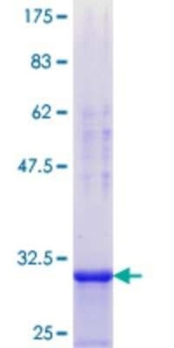 Novus Biologicals Recombinant Human DDX3 GST (N-Term) Protein 10 &mu;g | Buy Online | Novus Biologicals&trade; | Fisher Scientific