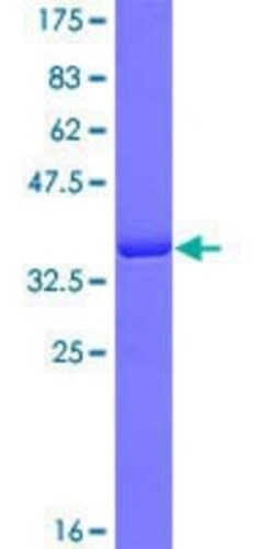 Novus Biologicals Recombinant Human DHX8 GST (N-Term) Protein 10 &mu;g | Buy Online | Novus Biologicals&trade; | Fisher Scientific