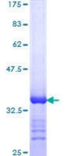 Novus Biologicals Recombinant Human RNA Helicase A GST (N-Term) Protein 10 &mu;g | Buy Online | Novus Biologicals&trade; | Fisher Scientific