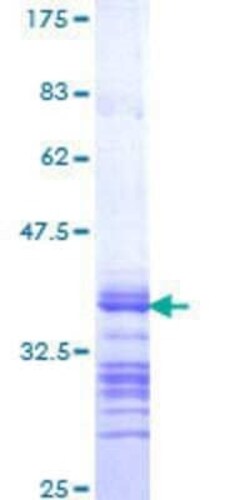 Novus Biologicals Recombinant Human DDX11 GST (N-Term) Protein 10 &mu;g | Buy Online | Novus Biologicals&trade; | Fisher Scientific