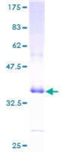 Novus Biologicals Recombinant Human alpha-Defensin 1 GST (N-Term) Protein 25 &mu;g | Buy Online | Novus Biologicals&trade; | Fisher Scientific