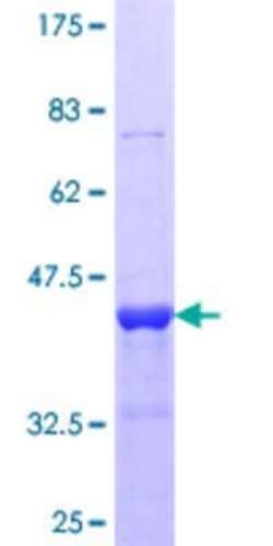 Novus Biologicals Recombinant Human Desmin GST (N-Term) Protein 10 &mu;g | Buy Online | Novus Biologicals&trade; | Fisher Scientific