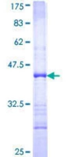 Novus Biologicals Recombinant Human DFF40/CAD GST (N-Term) Protein 25 &mu;g | Buy Online | Novus Biologicals&trade; | Fisher Scientific