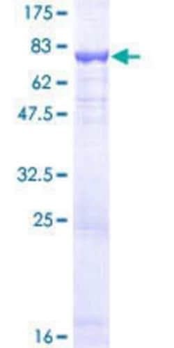 Novus Biologicals&trade;&nbsp;Recombinant Human Dfna5 GST (N-Term) Protein