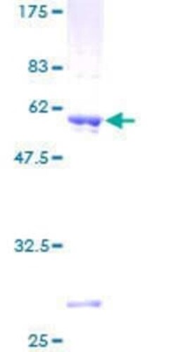 Novus Biologicals Recombinant Human Deoxyguanosine kinase GST (N-Term) Protein 2 &mu;g | Buy Online | Novus Biologicals&trade; | Fisher Scientific