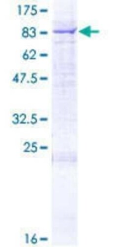 Novus Biologicals Recombinant Human Seladin 1 GST (N-Term) Protein 2 &mu;g | Buy Online | Novus Biologicals&trade; | Fisher Scientific