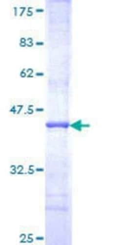 Novus Biologicals Recombinant Human DIAPH1 GST (N-Term) Protein 10 &mu;g | Buy Online | Novus Biologicals&trade; | Fisher Scientific
