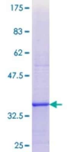 Novus Biologicals Recombinant Human DIO1 GST (N-Term) Protein 10 &mu;g | Buy Online | Novus Biologicals&trade; | Fisher Scientific