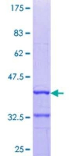 Novus Biologicals Recombinant Human DIO3 GST (N-Term) Protein 25 &mu;g | Buy Online | Novus Biologicals&trade; | Fisher Scientific